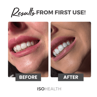 ISOHEALTH Teeth Whitening Strips (28 strips) Available In Clear Or Carbon - ISOCLEAN